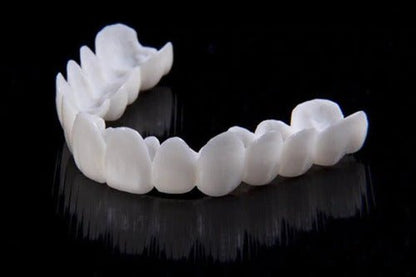 Dental veneers made from flexible, high-quality resin, designed for a natural appearance and comfortable wear, ideal for enhancing smiles. 5