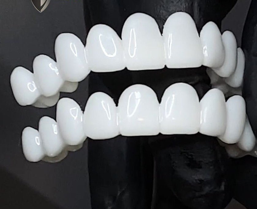 Dental veneers made from flexible, high-quality resin, designed for a natural appearance and comfortable wear, ideal for enhancing smiles. 4