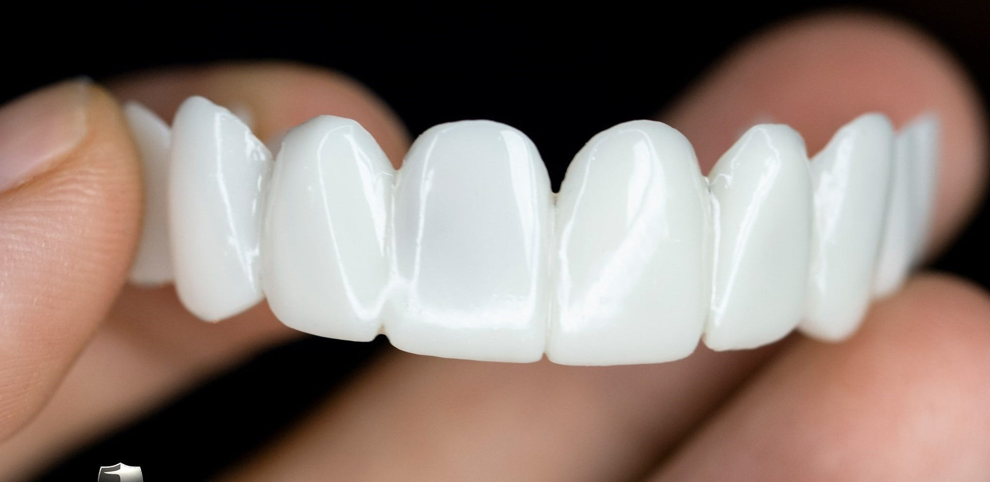 Dental veneers made from flexible, high-quality resin, designed for a natural appearance and comfortable wear, ideal for enhancing smiles. 3