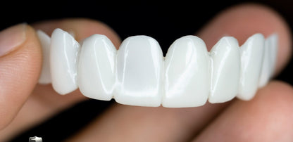 Dental veneers made from flexible, high-quality resin, designed for a natural appearance and comfortable wear, ideal for enhancing smiles. 3