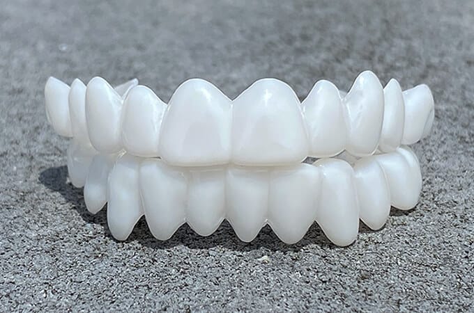 Dental veneers made from flexible, high-quality resin, designed for a natural appearance and comfortable wear, ideal for enhancing smiles. 1