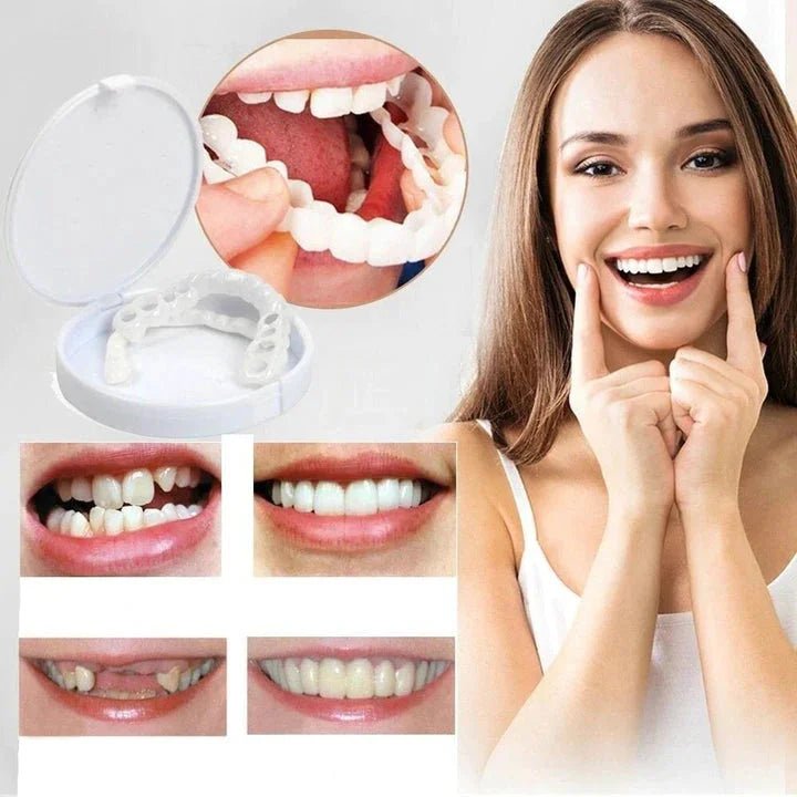 Snap-On Veneers for an Instant Smile Enhancement featuring a Natural Look, made from Comfortable Fit Medical-Grade Polypropylene for a seamless appearance. 1