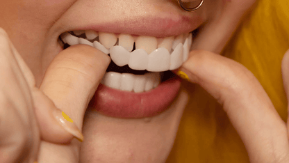 Snap-On Veneers for an Instant Smile Enhancement featuring a Natural Look, made from Comfortable Fit Medical-Grade Polypropylene for a seamless appearance. 6